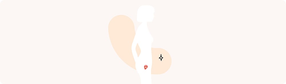 1 SG (semaines de grossesse, équivalent 3 SA)