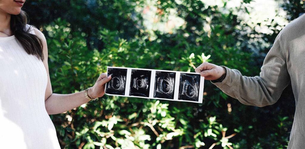 Couple regardant ensemble des échographies illustrant le rôle du co-parent pendant la grossesse