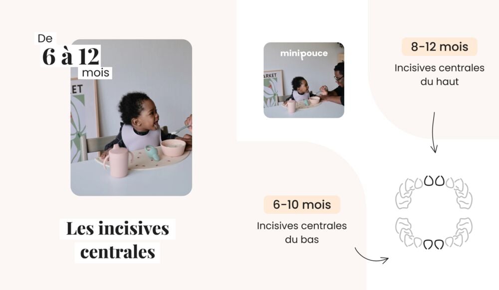 Guide visuel du calendrier dentaire bébé 6 à 12 mois, montrant les incisives centrales et l’âge d’apparition des premières dents bébé