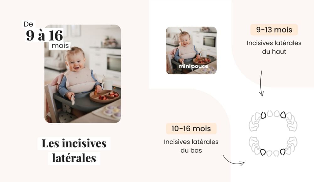 Schéma pédagogique des incisives latérales de bébé (9 à 16 mois), repères clairs pour comprendre l’évolution des dents de bébé